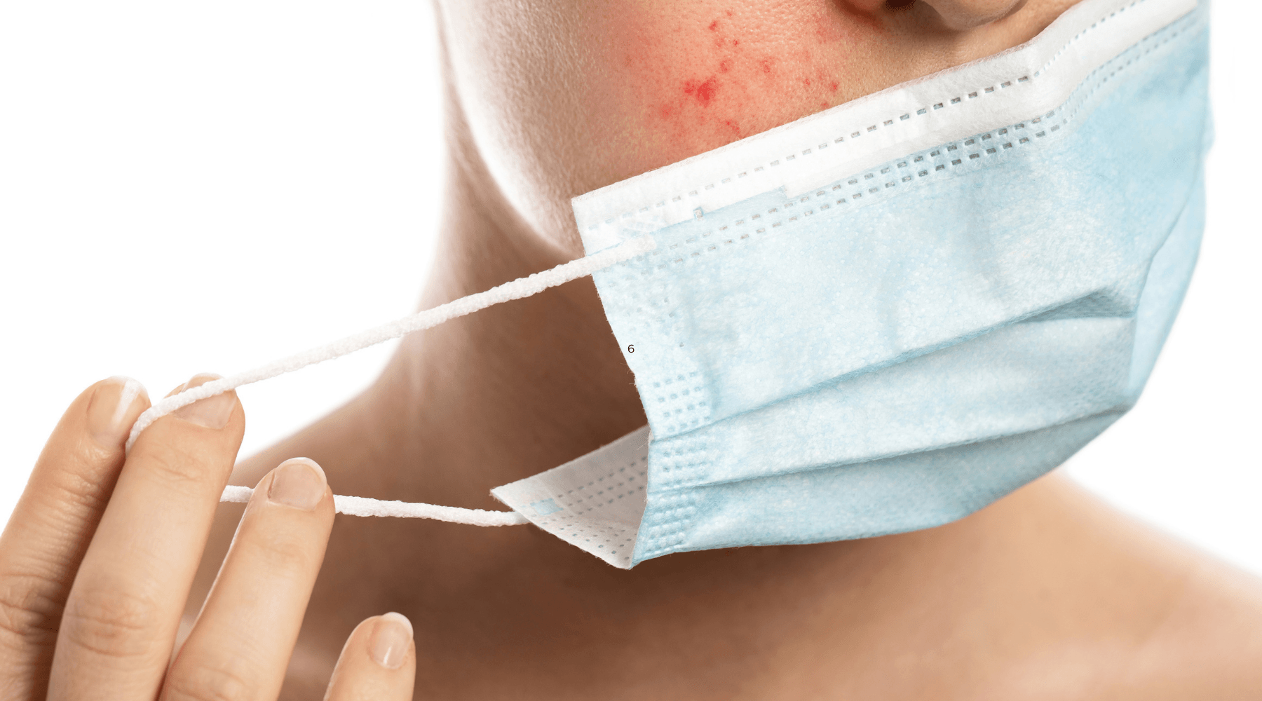 Can Wearing Face Masks Cause Acne & Other Skin Conditions? LOOKEETech