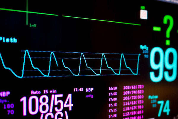 A Guide To The Perfusion Index In Pulse Oximeters