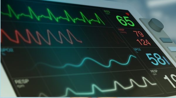 What is an EKG and what does it show?
