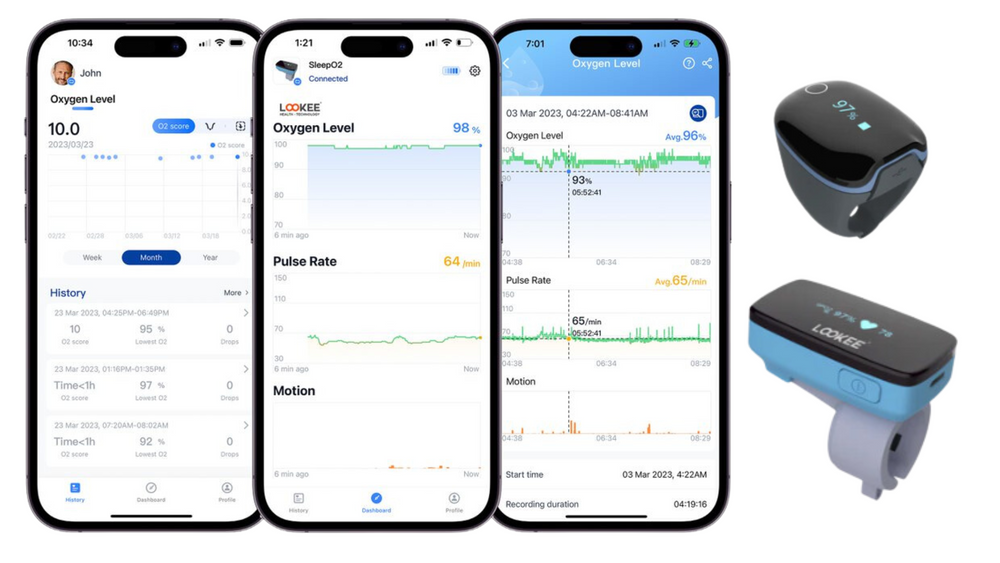Sleep Monitor Example Top Features to Look for in a Sleep Oxygen Monitor | Sleep, Sleep apnea ...