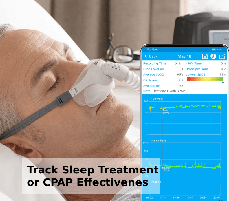 LOOKEE® Sleep Oxygen Monitors | Overnight Pulse Oximeter Track CPAP ...