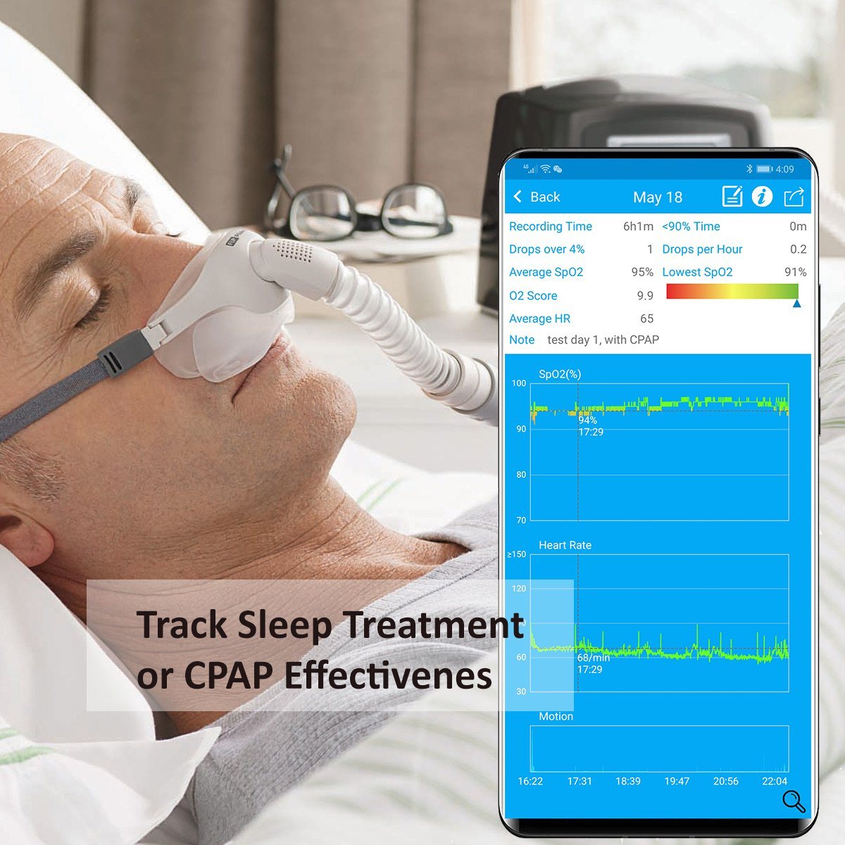 LOOKEE® Ring Sleep Oxygen Monitor with Vibration Alarm for Apnea Events & Low O2