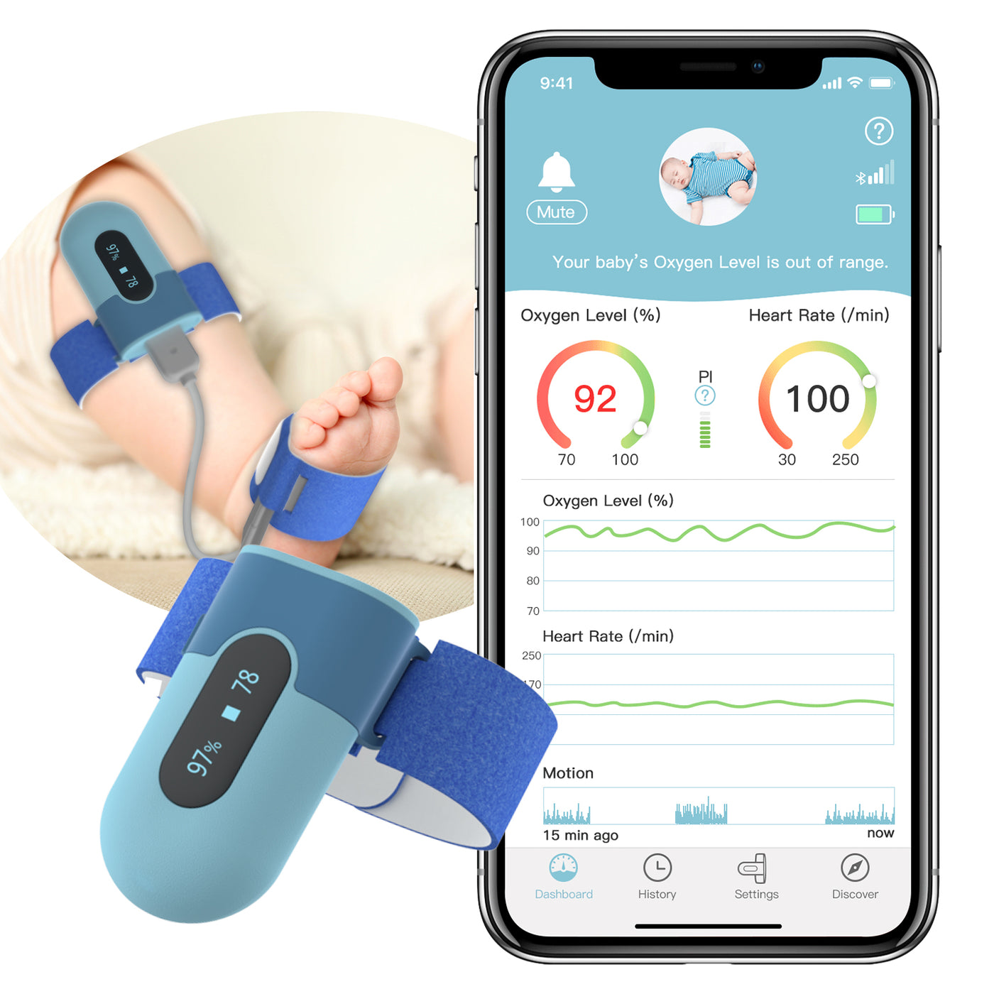 LOOKEE® BabyO2™ Baby Oxygen Monitor with Audio Alarm and App Notification | Track Oxygen Level, Heart Rate and Movement | Designed for 0-3 Years Old
