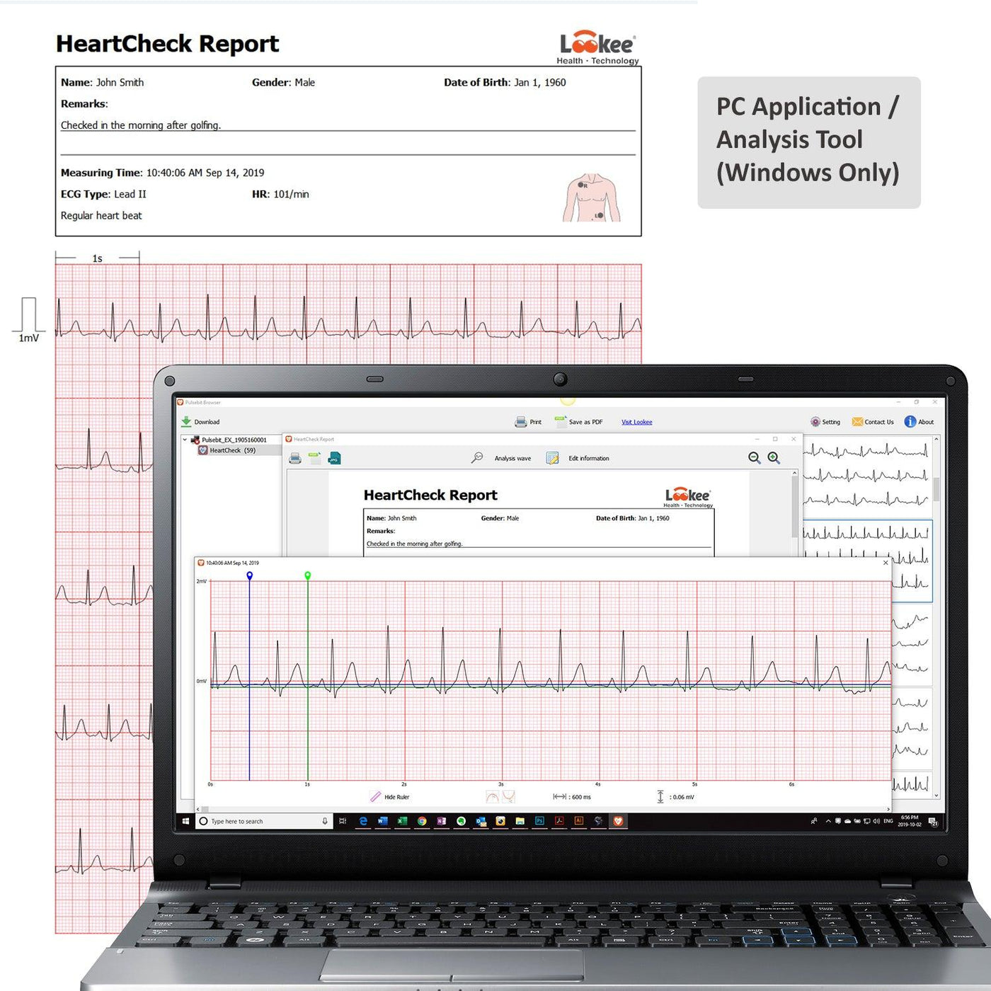 LOOKEE® home cardiac monitor with real-time EKG analysis