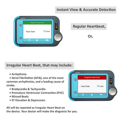 Lookee® Personal ECG / EKG Heart Monitor | Color Touch Screen | Cable or Cable Free Recording in 30s/60s/5Min | Detect Heart Abnormalities On The Go - Lookee Tech