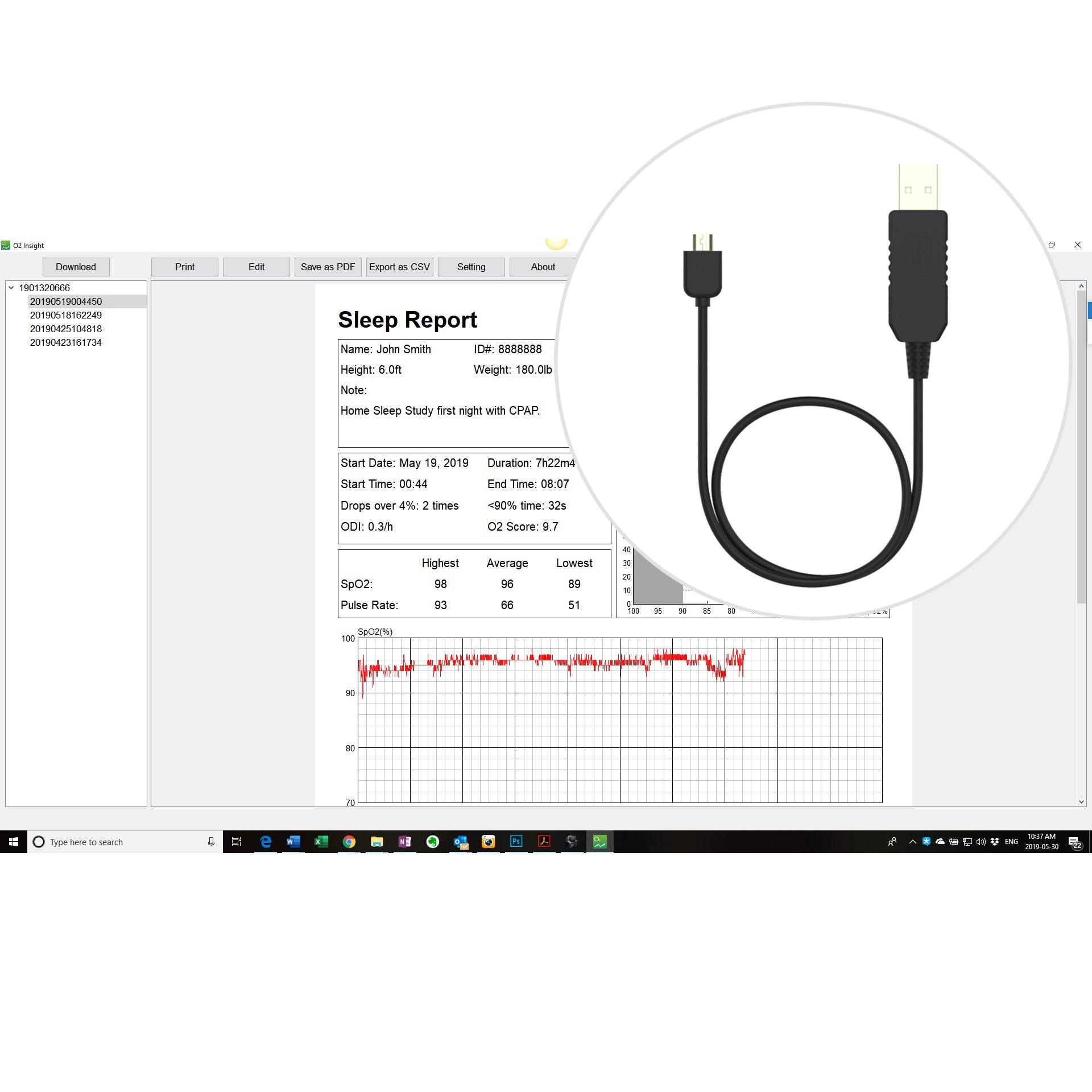 Dleep Computer Software Professional Version Upgrade Package for LOOKEE® Ring Sleep Monitor ...