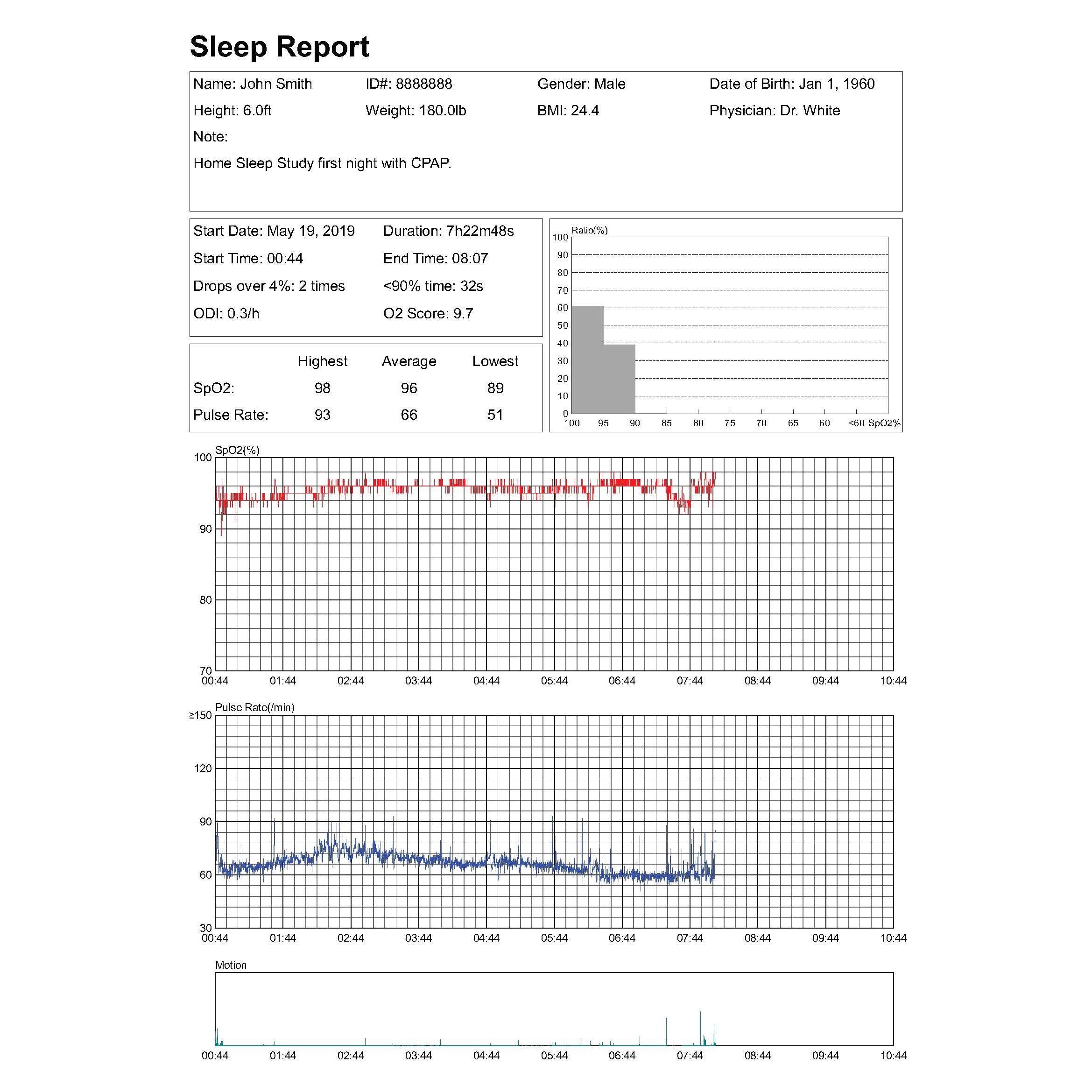 Professional Version Upgrade Package for Lookee® Ring Sleep Monitor, Including PC Software (windows only) and PC Data Cable - Lookee Tech