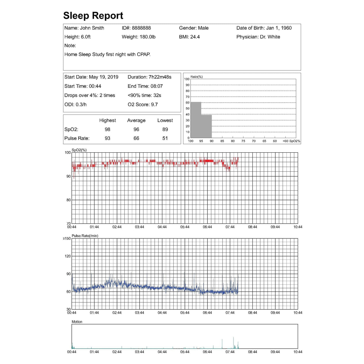 Professional Version Upgrade Package for Lookee® Ring Sleep Monitor, Including PC Software (windows only) and PC Data Cable - Lookee Tech