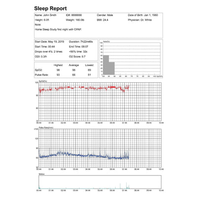 Professional Version Upgrade Package for Lookee® Ring Sleep Monitor, Including PC Software (windows only) and PC Data Cable - Lookee Tech